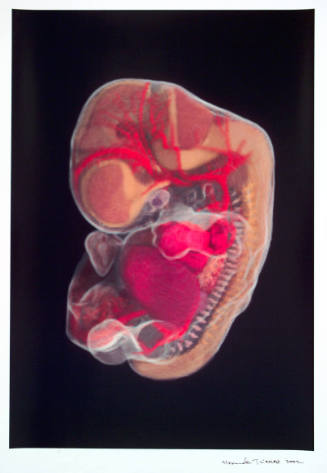 Human Embryo: Forty-Four Days (Transparent)